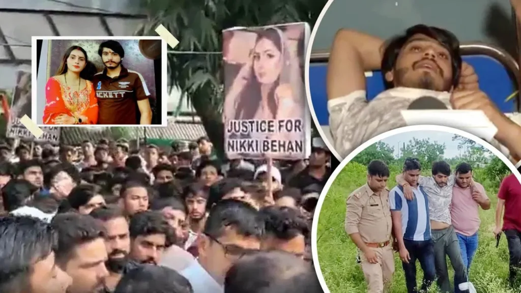 ग्रेटर नोएडा: पत्नी को जिंदा जलाने वाले विपिन का एनकाउंटर, पैर में लगी गोली, बोला- मुझे नहीं है पछतावा