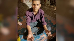 Agra News: पुलिस की ‘थर्ड डिग्री’ से हाईस्कूल के छात्र का हाथ टूटा, 2 दारोगाओं पर हुआ एक्शन