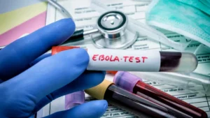 Ebola Scare Rajasthan: राजस्थान के लिए राहत; युगांडा से आई युवती की इबोला रिपोर्ट आई नेगेटिव