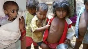 Malnutrition in MP: सरकारी दावों की खुली पोल; NFHS-6 रिपोर्ट में मध्य प्रदेश में कुपोषण का स्तर बढ़ा, बढ़ी चिंता