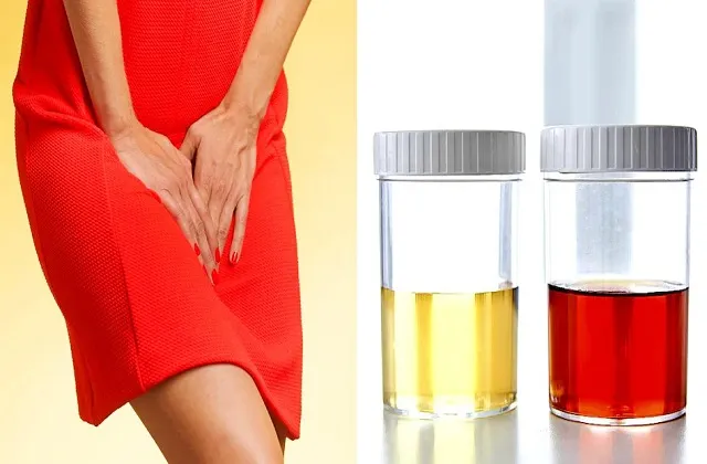 Kidney Cancer Symptoms: सिर्फ दर्द ही नहीं, शरीर के ये 7 संकेत भी हो सकते हैं किडनी कैंसर का इशारा