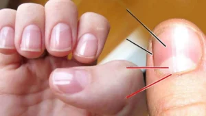 Fingernail Lunula Meaning: नाखूनों पर बने सफेद अर्धचंद्र से जानें अपना भविष्य और भाग्य