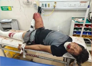 अंबाला-दिल्ली हाईवे पर हड़कंप! पत्नी से विवाद के बाद ट्रक के आगे कूदा पति, अस्पताल में कैंची से हमले की कोशिश