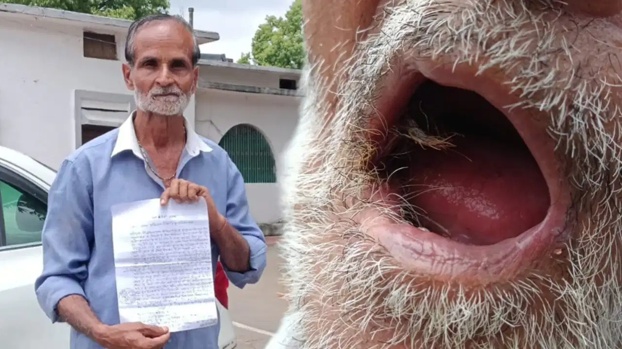 जबलपुर: मुंह के कैंसर ऑपरेशन में भारी चूक! गाल के अंदर डॉक्टर ने लगाई ठुड्डी की स्किन, पीड़ित ने लगाया धोखाधड़ी का आरोप