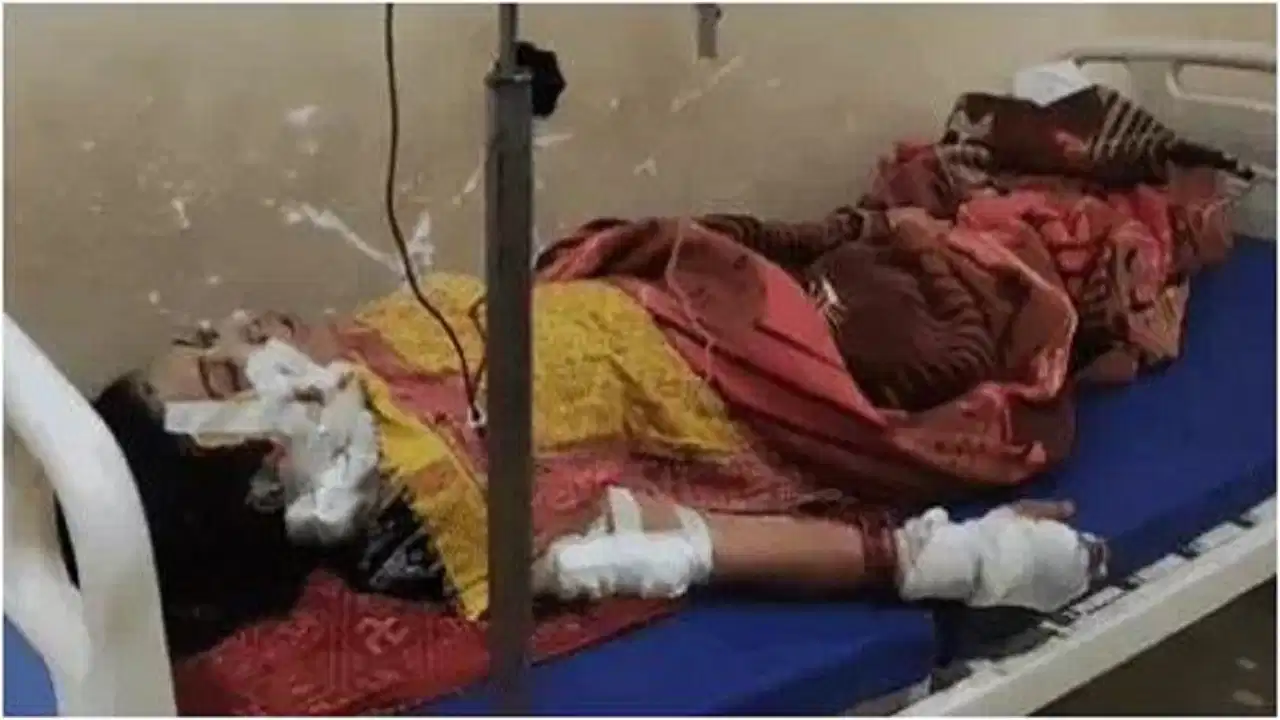 Bihar Domestic Violence News: फोन-पे के पैसों को लेकर विवाद में हैवान बना पति, 3 घंटे चले ऑपरेशन और 150 टांकों के बाद बची महिला की जान