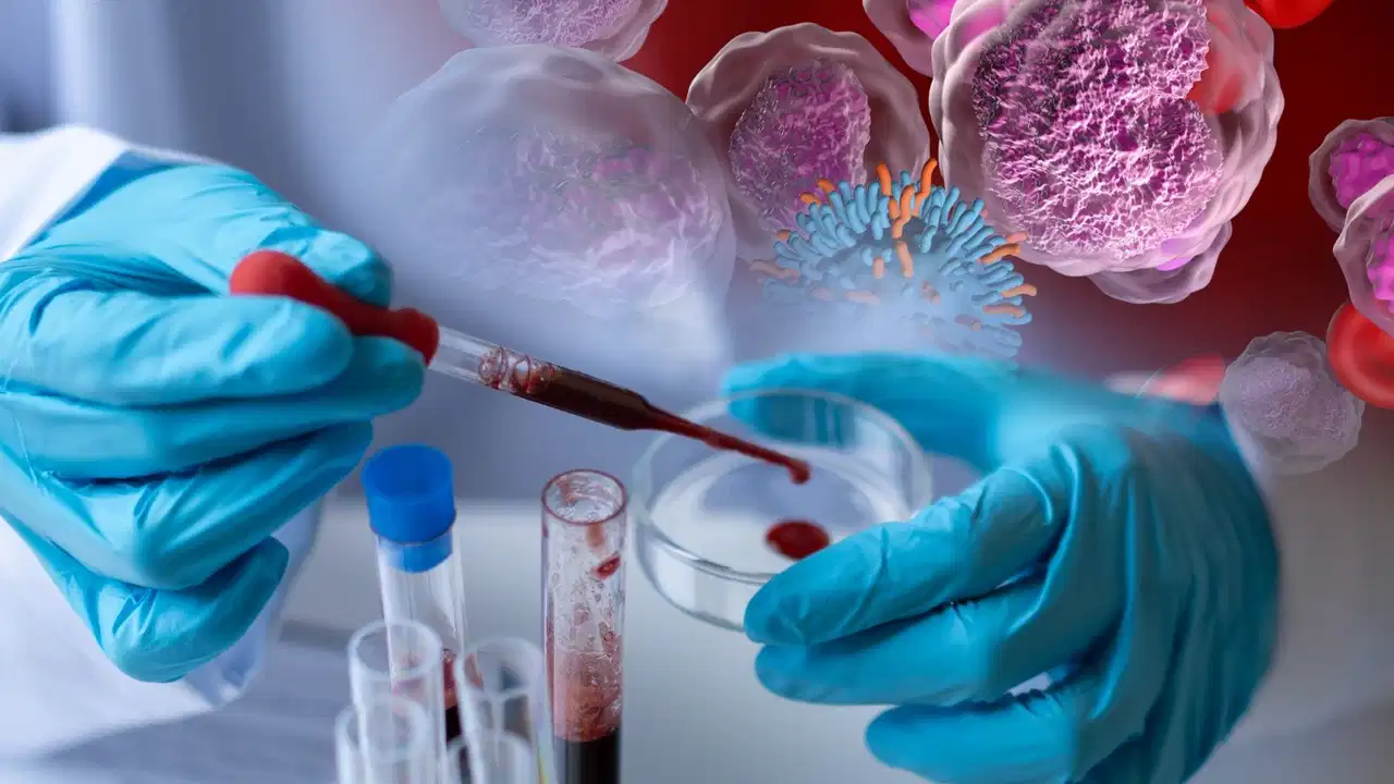 Blood Cancer Diagnosis: सीबीसी टेस्ट, बायोप्सी या बोन मैरो? जानें ब्लड कैंसर की सटीक जांच और आधुनिक इलाज के विकल्प
